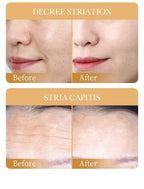 Masques Visage SADOER